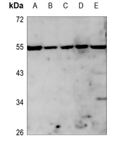 1 - Anti-PLK5 Antibody AP59890
