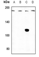 1 - Anti-IQGAP3 Antibody AP59891