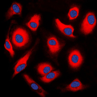3 - Anti-APOA1BP Antibody AP59892