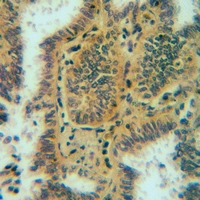19 - Anti-APOA1BP Antibody AP59892