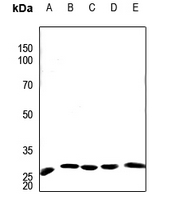 1 - Anti-APOA1BP Antibody AP59892