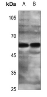 1 - Anti-ZNF280A Antibody AP59893