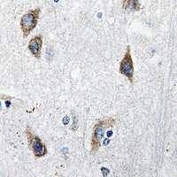 19 - Anti-Neuromedin S Antibody AP59894