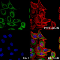 3 - Anti-CD200R Antibody AP59895