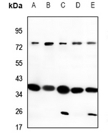 1 - Anti-CD200R Antibody AP59895