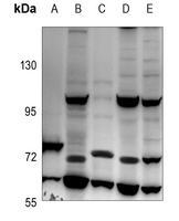1 - Anti-IL-31RA Antibody AP59896