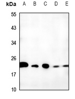 1 - Anti-TCEAL6 Antibody AP59898