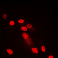 3 - Anti-SYNE3 Antibody AP59899