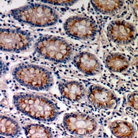 19 - Anti-TRPV3 Antibody AP59900