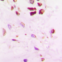 19 - Anti-SENP5 Antibody AP59902
