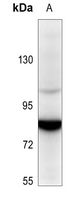 1 - Anti-SENP5 Antibody AP59902
