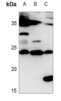 1 - Anti-IL-28A Antibody AP59903