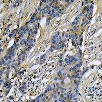 19 - Anti-RIMKLA Antibody AP59904