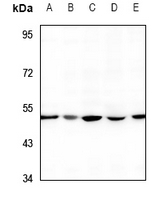 1 - Anti-RIMKLA Antibody AP59904