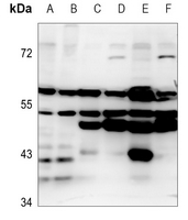 1 - Anti-EMR4 Antibody AP59906