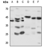 1 - Anti-Kappa-actin Antibody AP59907