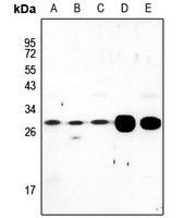 1 - Anti-LDLRAD2 Antibody AP59910