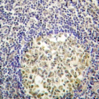 19 - Anti-p47 phox (Phospho-S370) Antibody AP59911