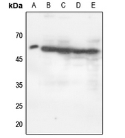 1 - Anti-p47 phox (Phospho-S370) Antibody AP59911
