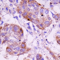 19 - Anti-Angiopoietin-2 Antibody AP59912