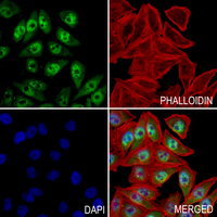 3 - Anti-ATM (Phospho-S1981) Antibody AP59913