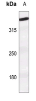 1 - Anti-ATM (Phospho-S1981) Antibody AP59913