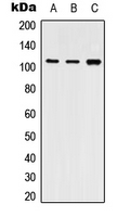1 - Anti-SERCA2 Antibody AP59916