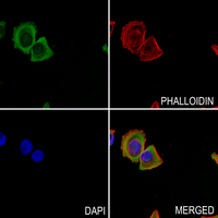 3 - Anti-Cav1.2 Antibody AP59918