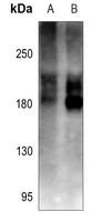 1 - Anti-Cav1.2 Antibody AP59918