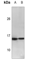 1 - Anti-Calcitonin Antibody AP59919
