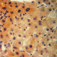 19 - Anti-CLCN1 Antibody AP59921