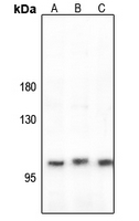 1 - Anti-CLCN1 Antibody AP59921