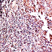 19 - Anti-GM-CSF Antibody AP59922