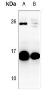 1 - Anti-GM-CSF Antibody AP59922