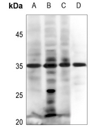 1 - Anti-EPO Antibody AP59923