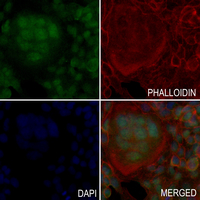 3 - Anti-HMGA1 Antibody AP59926