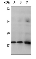 1 - Anti-HMGA1 Antibody AP59926
