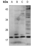 1 - Anti-IL-2 Antibody AP59927