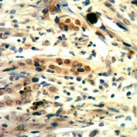 19 - Anti-c-Met (Phospho-Y1235) Antibody AP59929