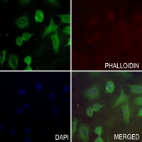 3 - Anti-PKLR Antibody AP59931