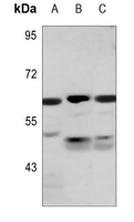 1 - Anti-PKLR Antibody AP59931