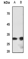 1 - Anti-SHOX Antibody AP59935