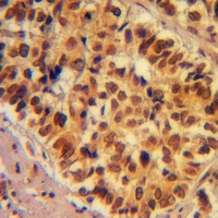 19 - Anti-SNRPD3 Antibody AP59938