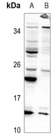 1 - Anti-SNRPD3 Antibody AP59938