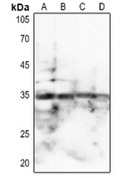 1 - Anti-SPARC Antibody AP59939