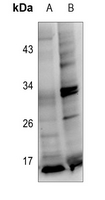 1 - Anti-Protachykinin 1 Antibody AP59940
