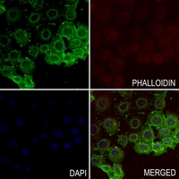 3 - Anti-TRPV1 Antibody AP59942