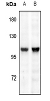 1 - Anti-TRPV1 Antibody AP59942