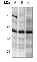 1 - Anti-DR5 Antibody AP59943