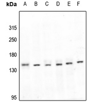 1 - Anti-LATS1 Antibody AP59945